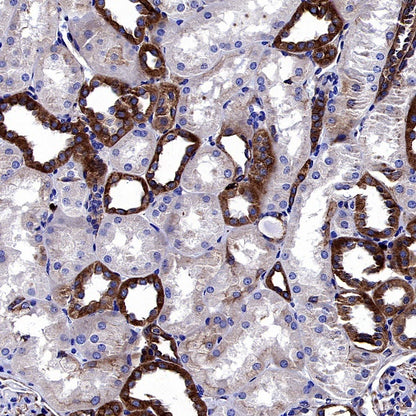 Human Cytoplasmic Marker Recombinant Mouse mAb (SDT-2921)