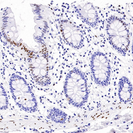 c-Fos Recombinant Rabbit mAb (S-1391-63)
