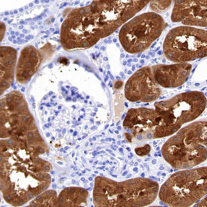 Pklr Recombinant Rabbit mAb (S-4114-40)