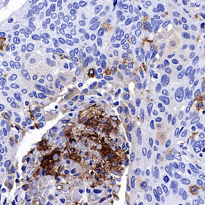 uPAR/CD87 Recombinant Rabbit mAb (S-3960-82)