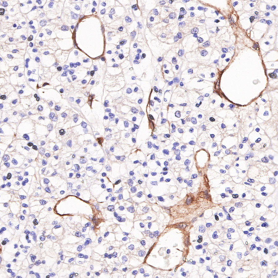 CD146 Recombinant Rabbit mAb (SDT-348-6)