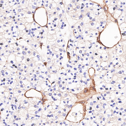 CD146 Recombinant Rabbit mAb (SDT-348-6)