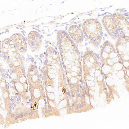 EIF2S2 Rabbit Polyclonal Antibody