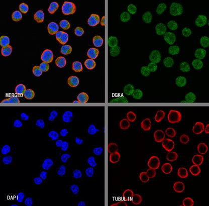 DGKA Recombinant Rabbit mAb (S-1933-121)