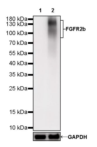 FGFR2b Recombinant Rabbit mAb (SDT-423-18)