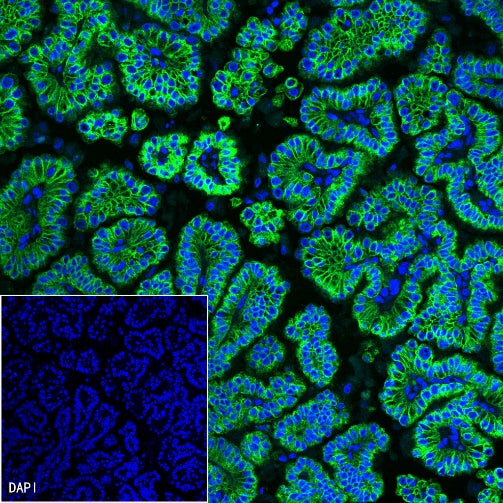 Cytokeratin 19 fragment (CY211) Recombinant Rabbit mAb (Alexa Fluor® 488 Conjugate) (SDT-197-28)