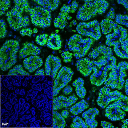 Cytokeratin 19 fragment (CY211) Recombinant Rabbit mAb (Alexa Fluor® 488 Conjugate) (SDT-197-28)