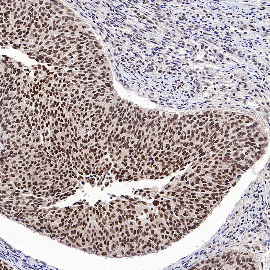 L-Lactyl Lysine Rabbit mAb