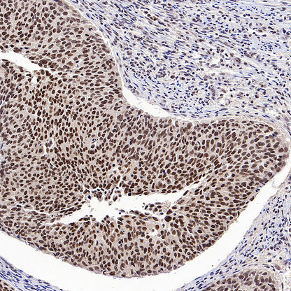 L-Lactyl Lysine Rabbit mAb