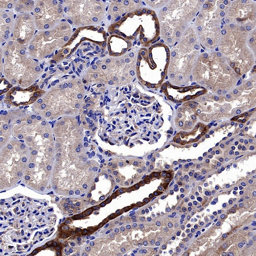 Atg5 Recombinant Rabbit mAb (S-3181)