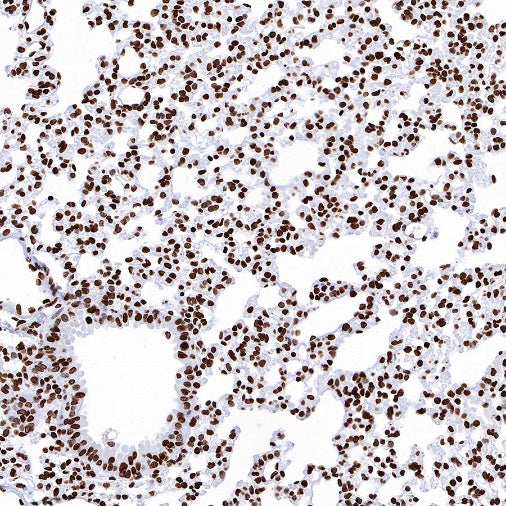 Histone H3 (mono methyl K36) Recombinant Rabbit mAb (S-R396)