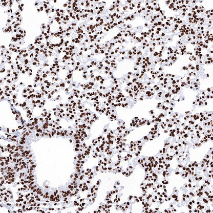 Histone H3 (mono methyl K36) Recombinant Rabbit mAb (S-R396)