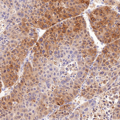 Glutamine Synthetase (GS) Recombinant Rabbit mAb (SDT-549-25)