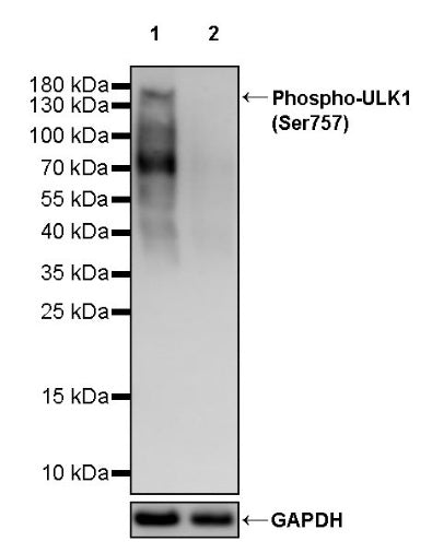 Phospho-ULK1 (Ser757) Recombinant Rabbit mAb (S-3495)