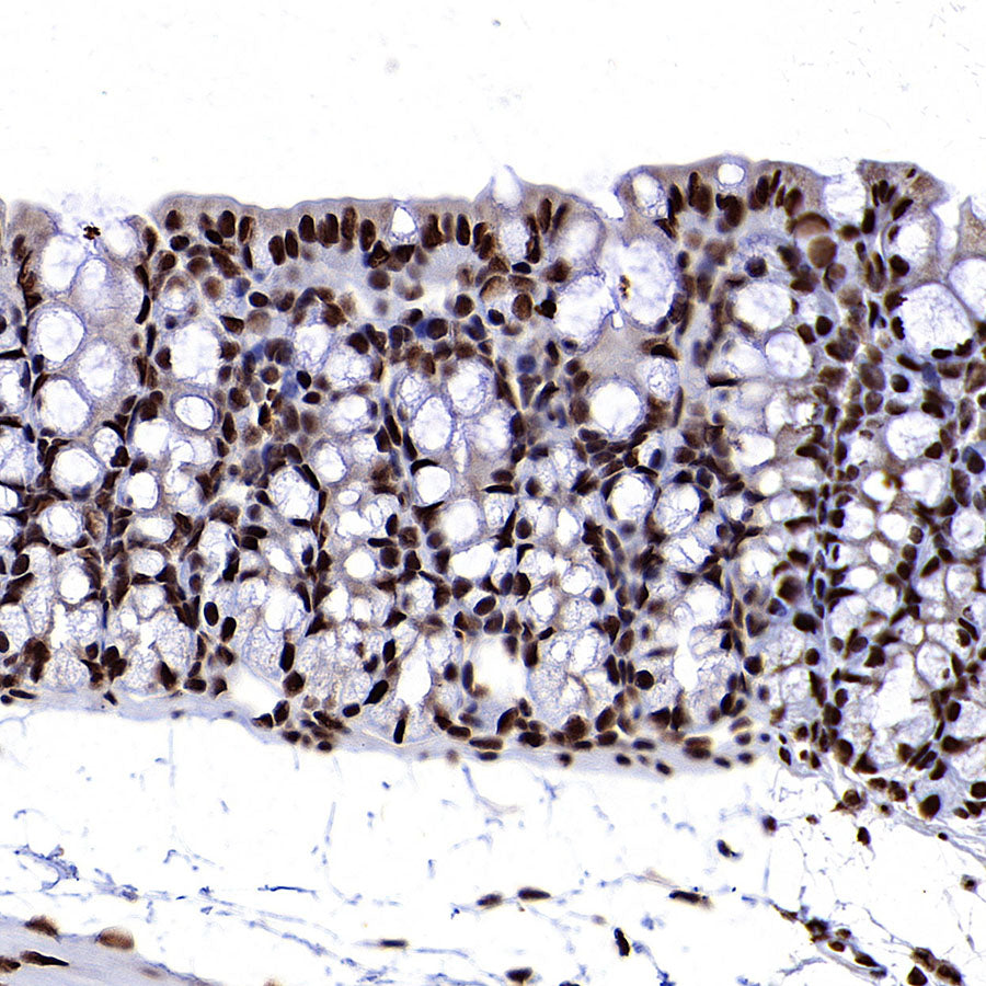 EIF4A3 Mouse mAb