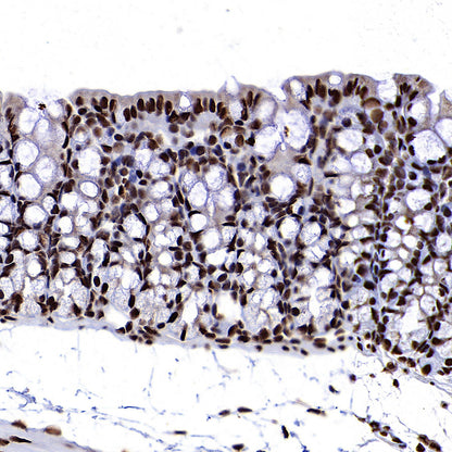 EIF4A3 Mouse mAb