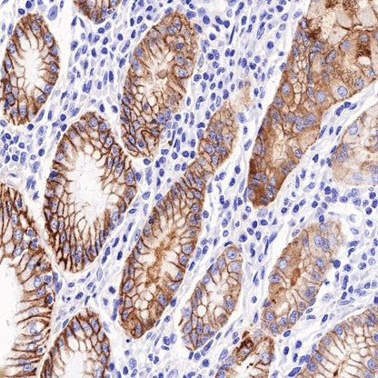 Antibody Diluent