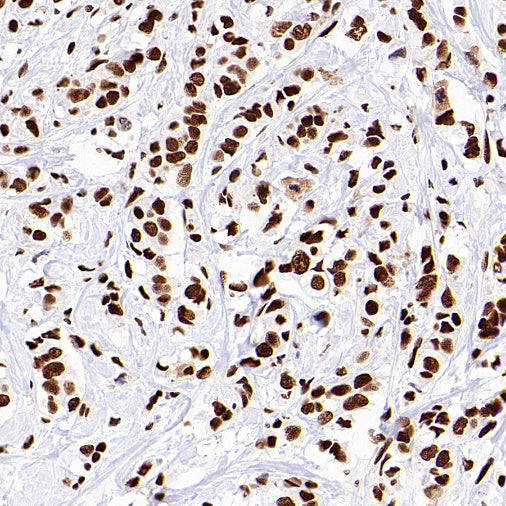 SP1 Recombinant Rabbit mAb (S-4102)