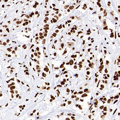 SP1 Recombinant Rabbit mAb (S-4102)