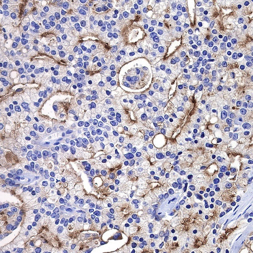 TMPRSS2 Recombinant Rabbit mAb (S-735-40)
