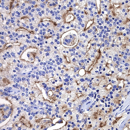 TMPRSS2 Recombinant Rabbit mAb (S-735-40)
