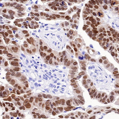PAX8 Recombinant Rabbit mAb (SDT-R509)