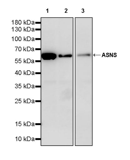 ASNS Recombinant Rabbit mAb (S-4216-14)