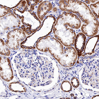 Ndufs4 Recombinant Rabbit mAb (S-1459-14)