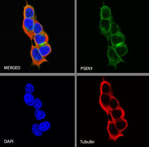 PSEN1 Recombinant Rabbit mAb (S-1002-129)
