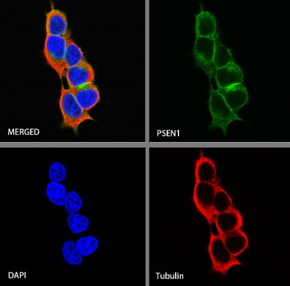 PSEN1 Recombinant Rabbit mAb (S-1002-129)