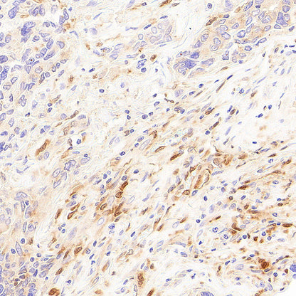 Galectin-9 Recombinant Rabbit mAb (S-4579-67)