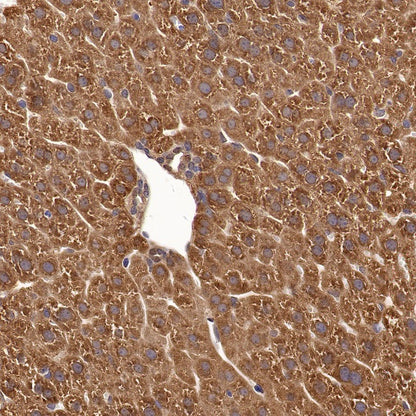 Peroxiredoxin 1/PAG Recombinant Rabbit mAb (S-1673-22)