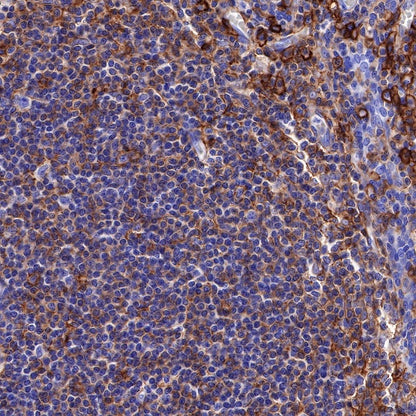 CD44 Recombinant Rabbit mAb (SDT-R107)