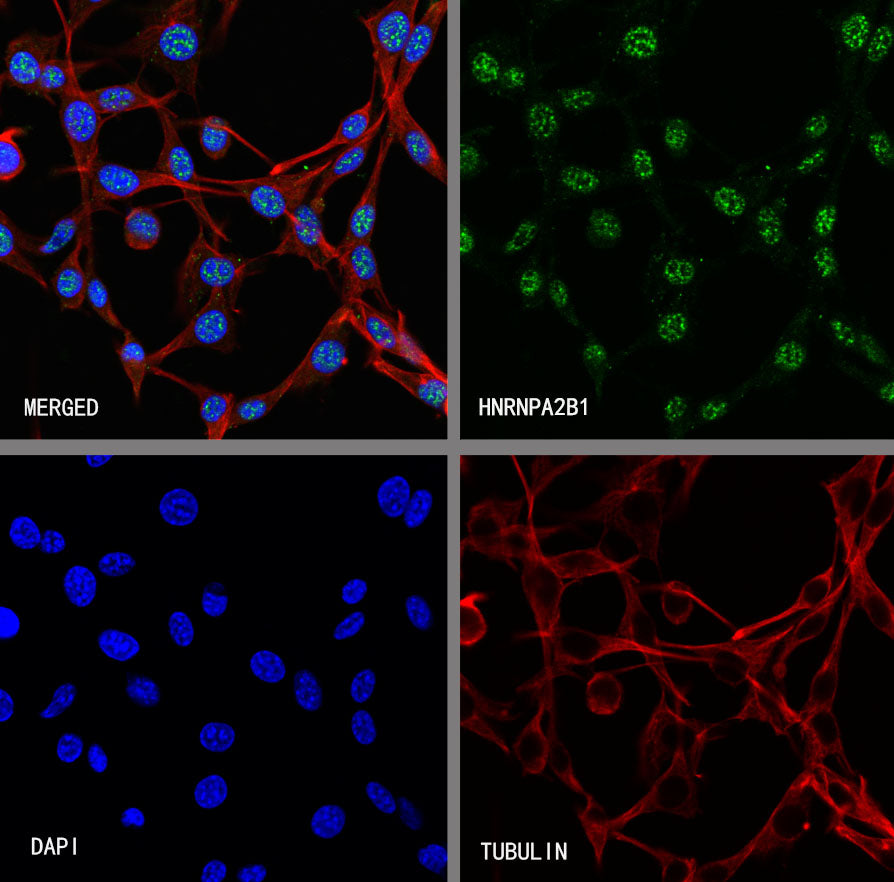HNRNPA2B1 Mouse mAb