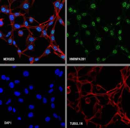 HNRNPA2B1 Mouse mAb