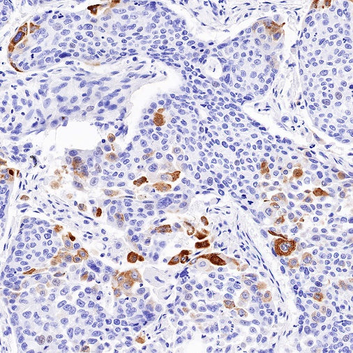 HuD/ELAVL4 Recombinant Rabbit mAb (S-1351-159)