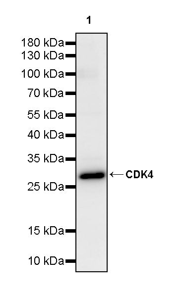 CDK4 Rabbit Polyclonal Antibody