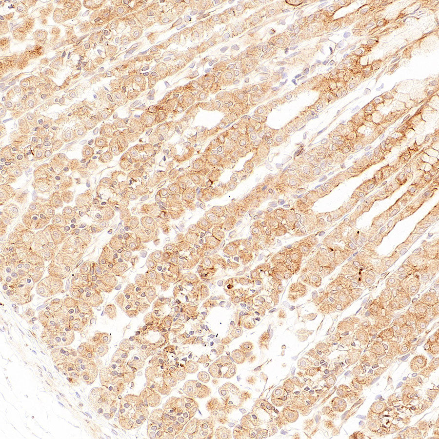 p58IPK/DNAJC3 Recombinant Rabbit mAb (S-4816-205)