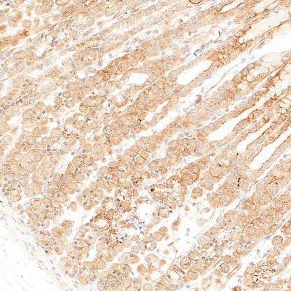 p58IPK/DNAJC3 Recombinant Rabbit mAb (S-4816-205)