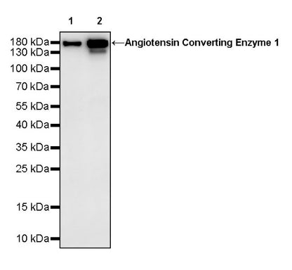 Angiotensin Converting Enzyme 1 Recombinant Rabbit mAb (SDT-2662-122)
