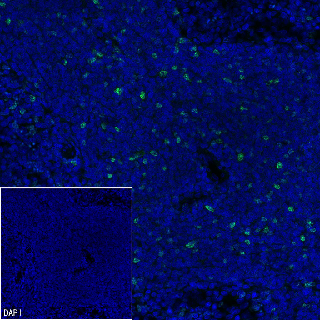 Ki67 Recombinant Rabbit mAb (S-4923-15)