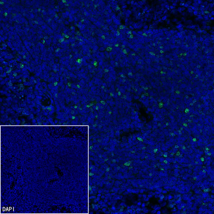 Ki67 Recombinant Rabbit mAb (S-4923-15)