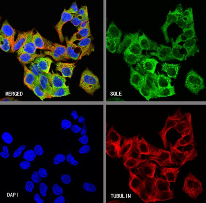 SQLE Recombinant Rabbit mAb (S-2358-207)