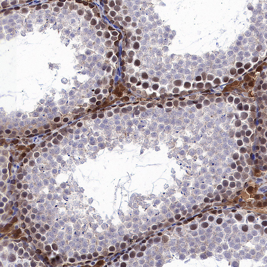 ATP Citrate Lyase Recombinant Rabbit mAb (S-5036)