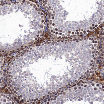 ATP Citrate Lyase Recombinant Rabbit mAb (S-5036)