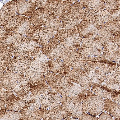 VDAC1 + VDAC2 + VDAC3 Rabbit Polyclonal Antibody