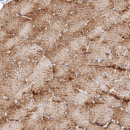 VDAC1 + VDAC2 + VDAC3 Rabbit Polyclonal Antibody