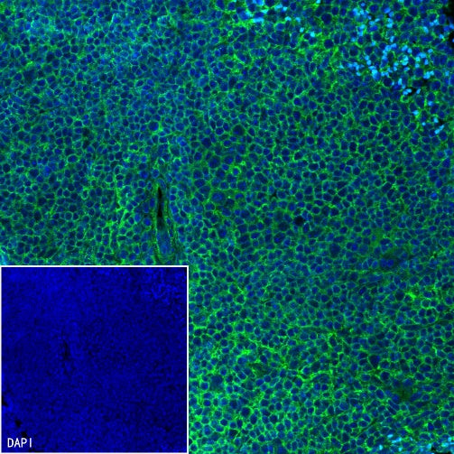 Integrin beta 4 Recombinant Rabbit mAb (S-1625-170)