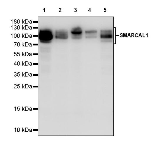 SMARCAL1 Recombinant Rabbit mAb (S-2110-328)