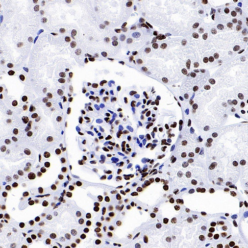 Histone H3 (acetyl K18) Recombinant Rabbit mAb (S-1688-90)
